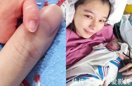 自然产|女明星为何宁愿剖腹产留疤,也不愿意顺产?背后3个原因,很现实