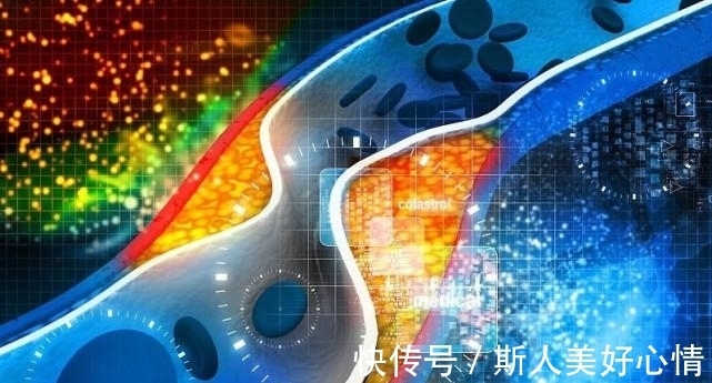 冠状动脉|动脉粥样硬化——随时可能引爆的定时炸弹