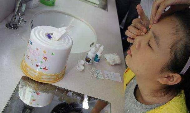 女儿错把502当眼药水,宝妈紧急处理挽救了娃,医生称赞:高明