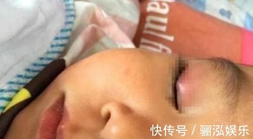 体温计|4岁孩子误把502滴入眼睛,宝妈60秒反应救了孩子,医生:很高明
