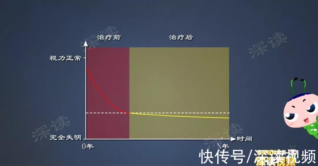 青光眼|视物模糊？畏光流泪？细数第二大致盲眼病——青光眼致盲前啥征兆