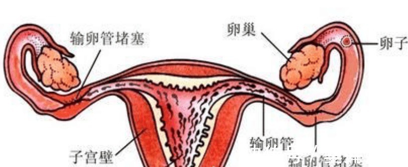 三胞胎|90后孕妇喜怀三胞胎, 关于孩子们的性别, 成为医院一大喜事