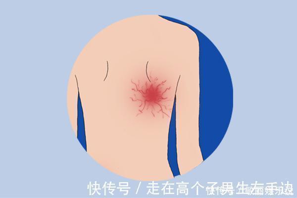 睡眠质量|女人雌激素快不足时,身体会出现丑态提醒你,若全占,需好好调理