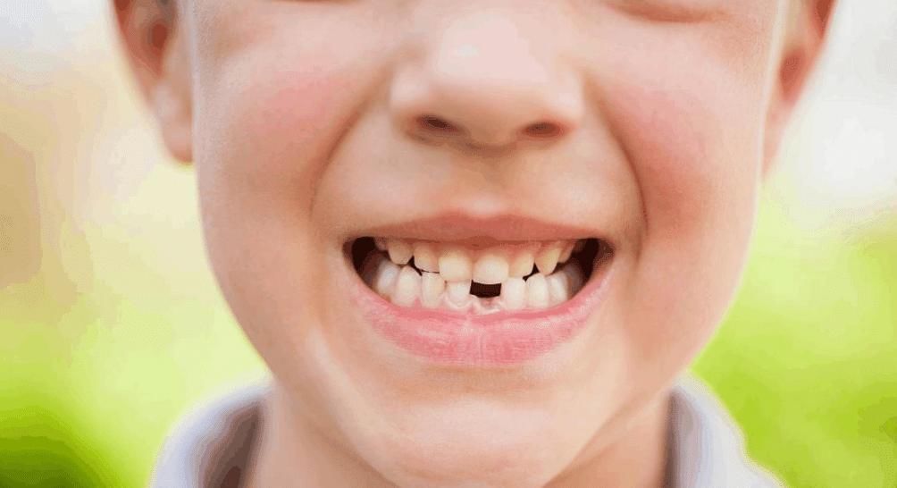 牙齿|95后宝妈不信乳牙能救命,结果后悔不已,新手爸妈要注意