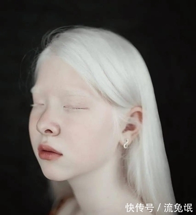 生而白首|一对罕见的“月亮姐妹”,被人嘲讽14年,拍完一组照片后惊艳众人