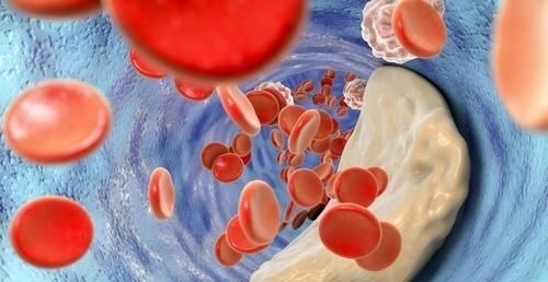 肥肉|为什么高血脂越来越多?医生直言:和肥肉无关,3种素食才是祸根