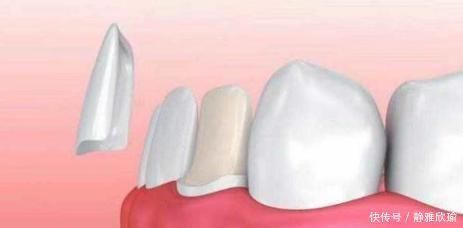 祛除|一个无比强大的方子,仅3味药,把痰湿彻底祛除,通体安泰