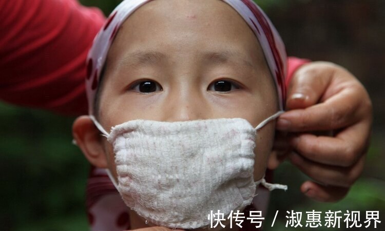 化学物质|为什么儿童白血病越来越多这3物才是“幕后黑手”,以后少买!