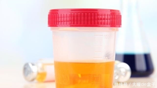 生活中|肾好的男人,一天排尿次数不会超过“几数”?