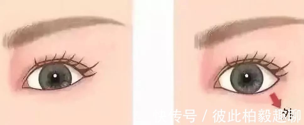 整形 这5个医美项目虽然很火,但很多医生不建议做!丨科普篇