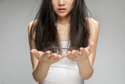 冬天|为什么冬天洗头掉发更多?别再吓唬自己了!