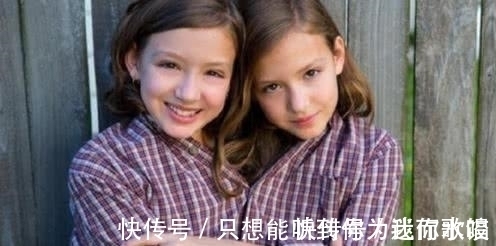 连体|若连体婴儿其中一个不幸离世,另一个会怎样呢?