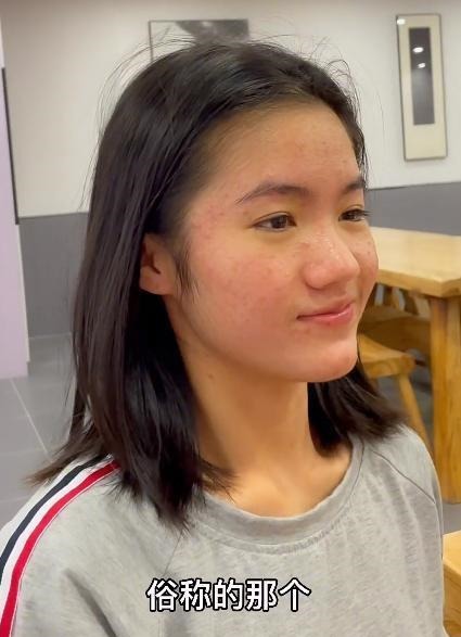 《变形计》李勒优生活大变，被城市家庭宠成公主，脸却长满痘痘