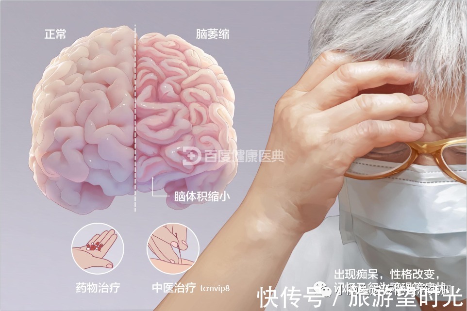 小脑萎缩|中医如何治疗小脑萎缩