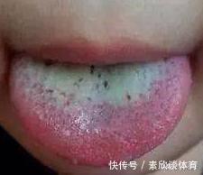 茯苓|养脸不如养脾,3样健脾祛湿好物,一定要吃