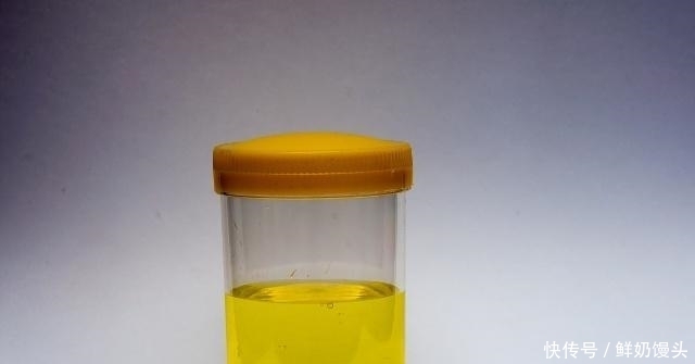 有糖尿病的人，若有这些表现，或许身体在慢慢好转，不妨自测！