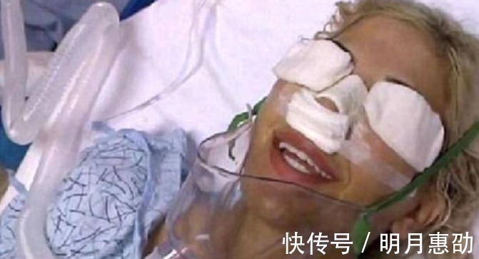 整容手术|女子花重金整容,一年经历13次整容手术,整容前后判若两人
