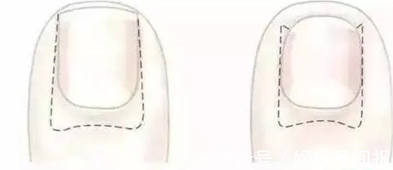 指甲|宝宝的指甲不能乱剪,否则可能致其受伤,这些细节父母谨记