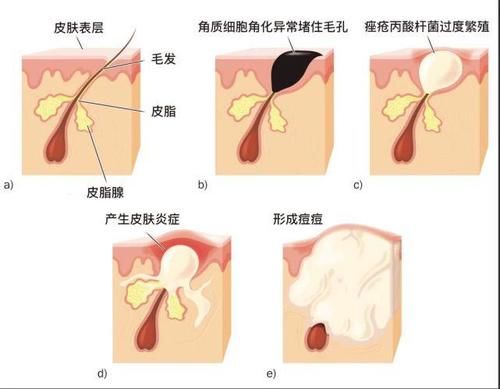 这4大美容项目，坑惨了多少中国女人！