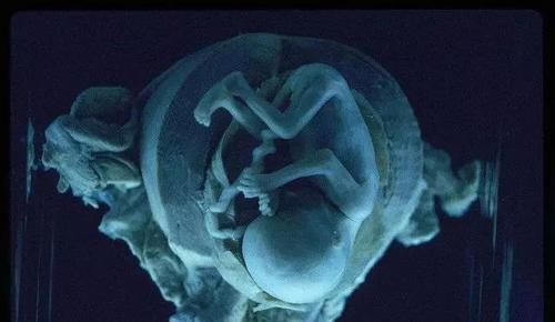 胎位|怀孕37周照B超,医生称不要顺产主任一分钟轻松搞定