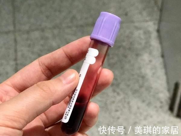 红糖水|中国疾控中心:孕妇贫血率高达35%,食疗补铁“吃对”才不白补