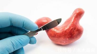 胃黏膜|养胃有七个忌讳，几件伤胃的事你可能天天在干，赶紧避免吧