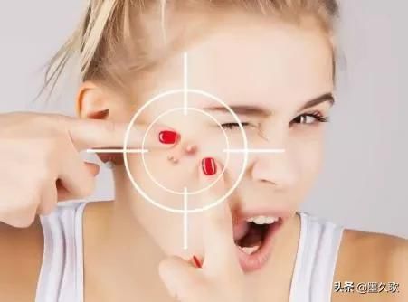 鼻子上挤出来的白色的，粘稠的丝状物，到底是啥东西？