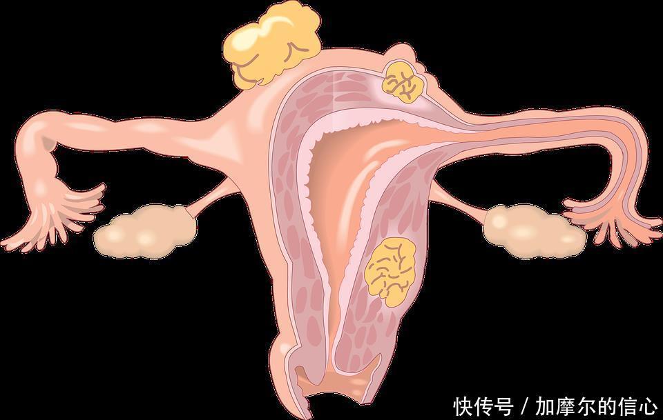 上环|上环对身体危害大吗3个安全避孕法，都比这个好