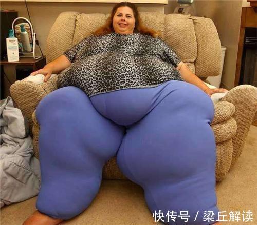 蘇珊娜·埃曼|美國女子因1450斤成網紅，不顧醫生勸告堅持生娃，如今娃長成這樣