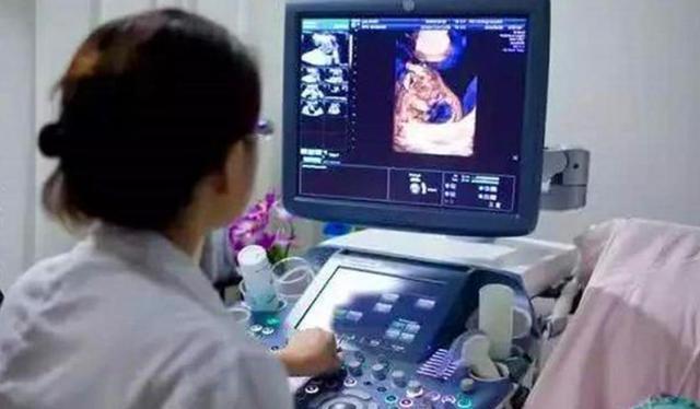 婚检|B超上孩子在做“鬼脸”,宝妈以为是调皮,医生却说孩子要不得