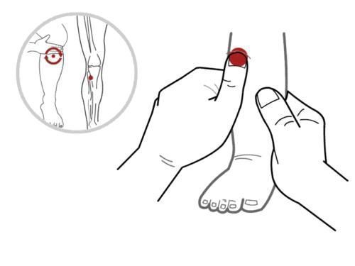 口腔|孩子口臭也有可能与鼻炎发作有关,别让积食去背锅!