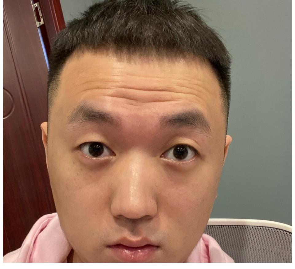 药水|向佐又要参加功夫嘉年华，药水哥上次被打怕了，新对手名气更大