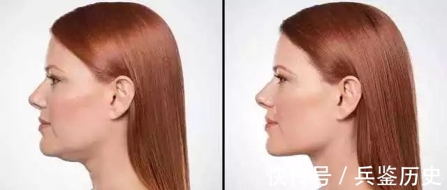 平直|如何有效瘦双下巴？