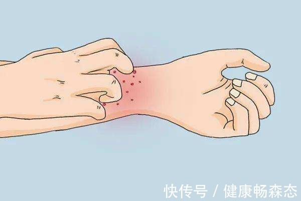 免疫细胞|口臭、皮肤过敏，这5个小毛病提示你肠道出了问题