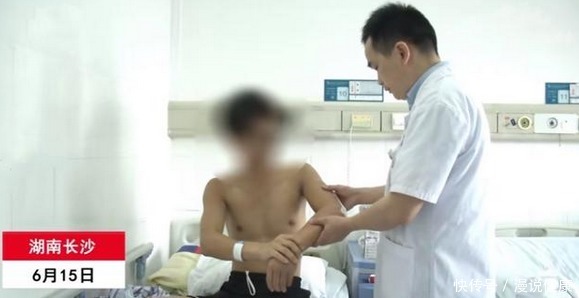 老年人|掰手腕突然骨折?为何现在年轻人的骨质疏松,要比老年人还严重?