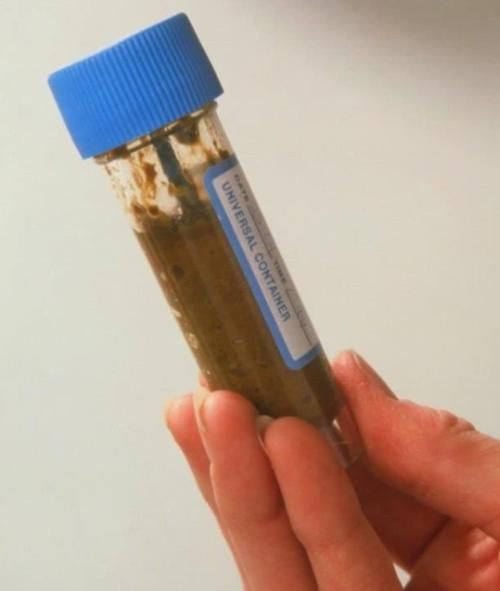 肝功能|肝功八项都正常说明肝正常吗？非也