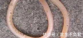 癥狀|孩子出現這5個癥狀, 就是肚子里長“蛔蟲”了！