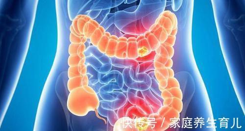 疗法|得了痔疮怎么办?老中医自用的“七分养三分治”疗法,快速消除痔疮肉球!