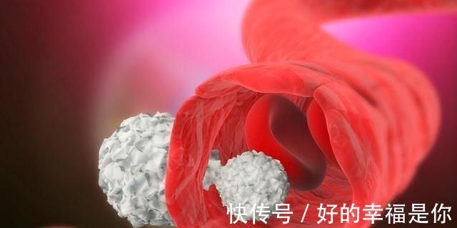 睡眠质量|血脂异常，睡觉可能有5种迹象，常喝2茶，保护血管，降血脂