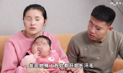 大v|“大头娃娃”再次出现,额头长满汗毛,这次是“毒护肤霜”惹的祸