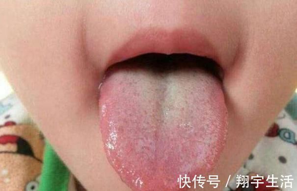 家长|孩子身上有三种现象,多半是积食了,此物比山楂更让孩子脾胃好