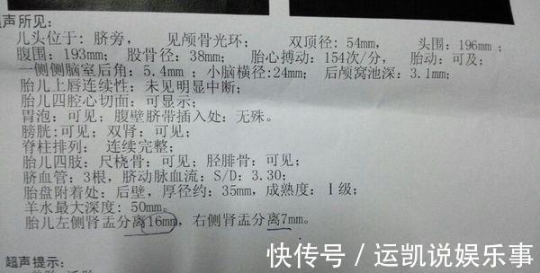 剩余分离|孕检时,B超单上若有4个字,别担心,可能是位“小公子”的暗号