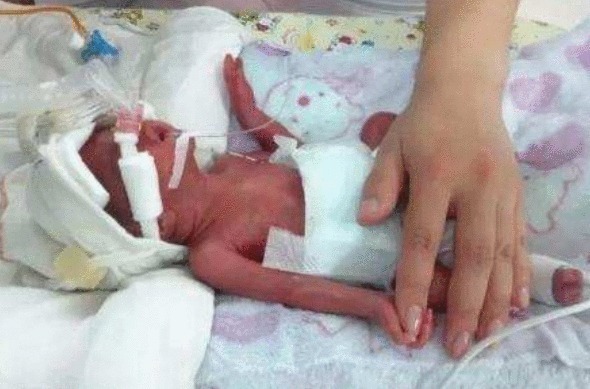 难产|孕妇生产三十四小时难产, 剖腹时竟没发现宝宝, 整个产房乱成一团