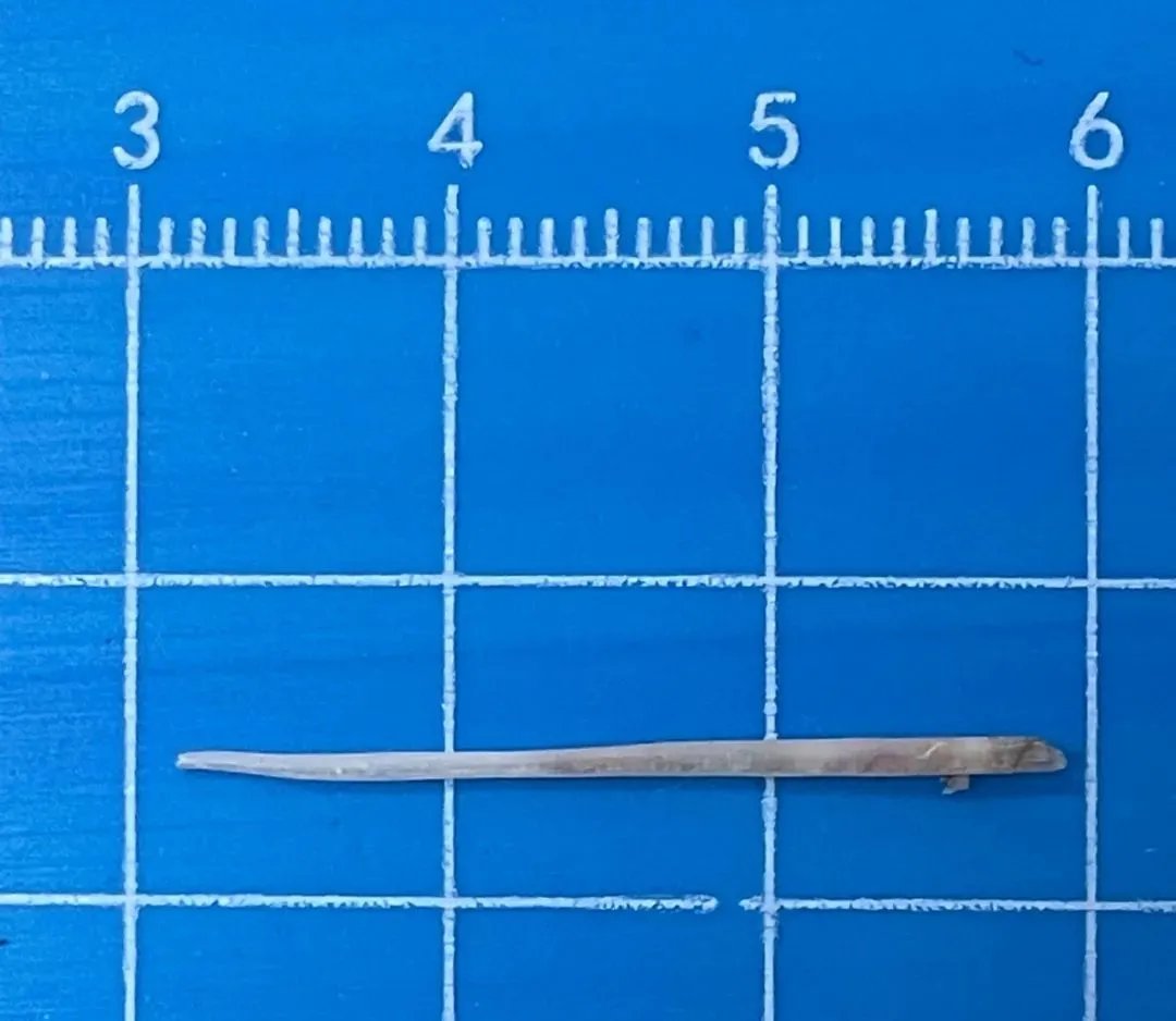 胰腺|鱼刺卡喉“土法”强行吞入，6个月后穿破胃壁引发胰腺炎，这些错误方法别再做了