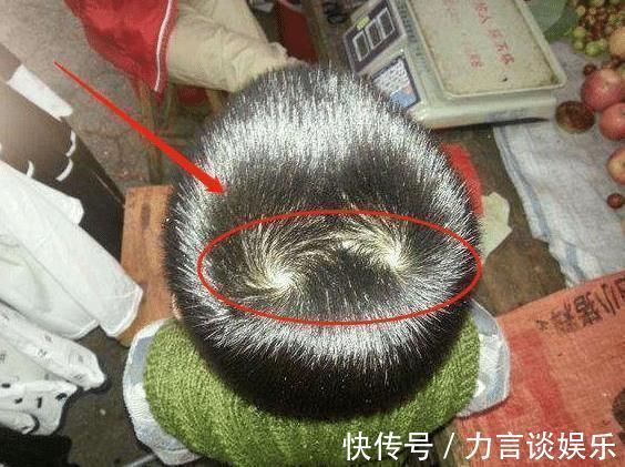 涨知识|为什么有的孩子头上有“2个旋”?代表啥意思?看完涨知识了
