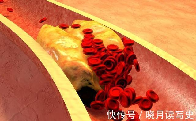 丹参|三七和丹参,哪个通血管好?别纠结了,这样做,给血管来个大扫除