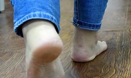 蜕皮|男性脚部若出现3个表现，多半“暗示”你与长寿有缘，早知早受益