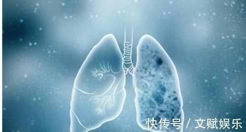 无鳞鱼|体内有“结节”的人,4种“发物”尽量少吃,不妨了解