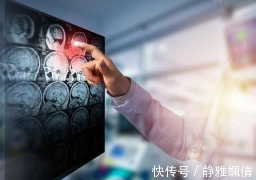 油炸|脑梗塞是吃出来的?劝告:四种食物能不吃就不吃,越吃血管越堵