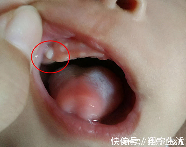 宝宝|新生儿双脚大面积蜕皮,宝妈火急火燎跑医院,医生看到却很淡定